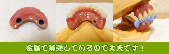 金属で補強しているので丈夫です!